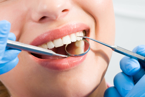 Photo of clean and healthy teeth being checked
