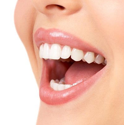 photo of the bottom half of a smiling woman's face showing perfect teeth